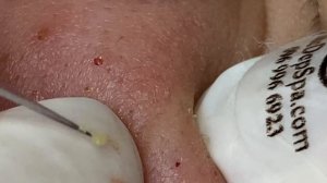 Relax Every Day With Sac Dep Spa #0387