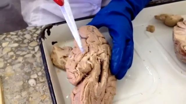 Конечный мозг смотреть онлайн