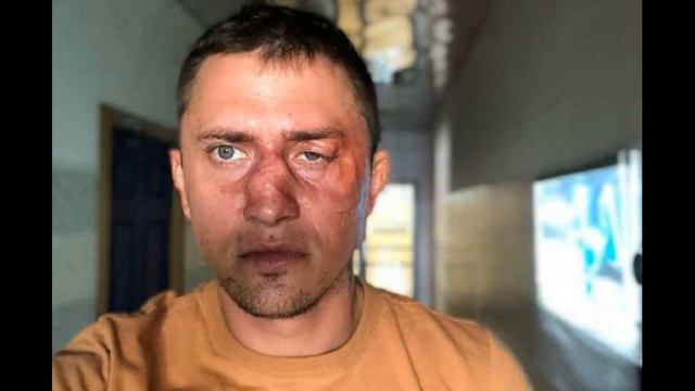 РАСКРЫТЫ ПОДРОБНОСТИ ИЗБИЕНИЯ АКТЁРА ПАВЛА ПРИЛУЧНОГО