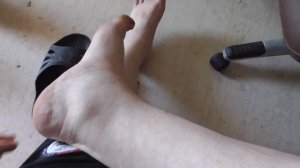 ОПУХЛИ НОГИ. ПОДРОБНЫЙ ОБЗОР