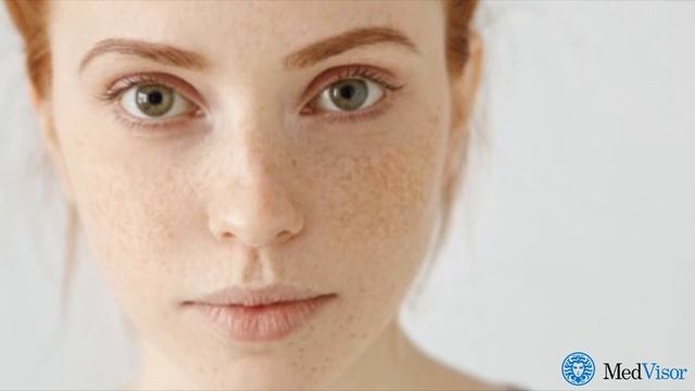 Какими способами можно избавиться от веснушек? смотреть онлайн