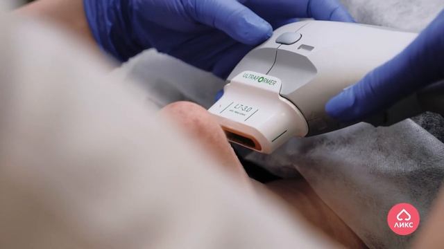 SMAS - ЛИФТИНГ НА АППАРАТЕ ULTRAFORMER смотреть онлайн