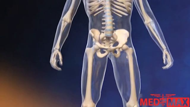 Остеосаркома. Что это за болезнь?