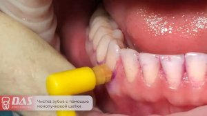 Для чего нужна монопучковая щетка?