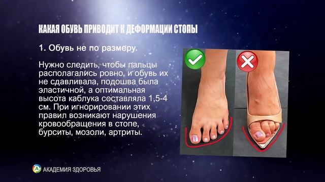 Правильная Анатомическая Обувь. Чем хорошая обувь отличается от плохой смотреть онлайн