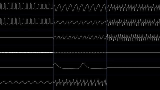 Jakerson - Comfort Hug (Oscilloscope View) смотреть онлайн
