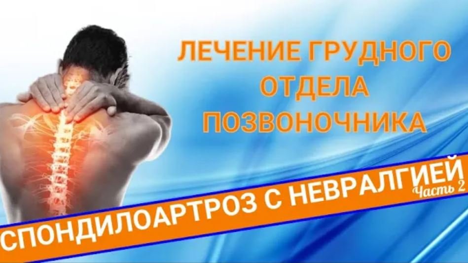 ЛЕЧЕНИЕ СПОНДИЛОАРТРОЗА ГРУДНОГО ОТДЕЛА ПОЗВОНОЧНИКА С МЕЖРЁБЕРНОЙ НЕВРАЛГИЕЙ (Часть 2) смотреть онлайн