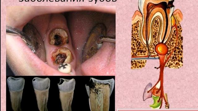 Зубы человека смотреть онлайн