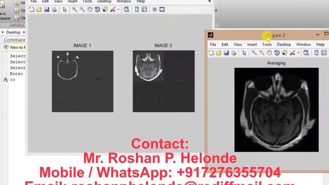 Matlab code for Image Fusion using Wavelet Transform смотреть онлайн