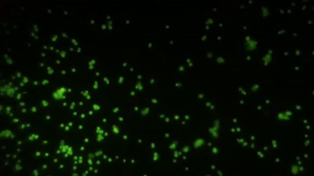 Сюжет НИИ биологии ИГУ «Умные микролампочки в байкальских рачках 1/3: В сетях иммунной системы» смотреть онлайн