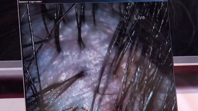 Компрессионный Тренажёр Волос смотреть онлайн