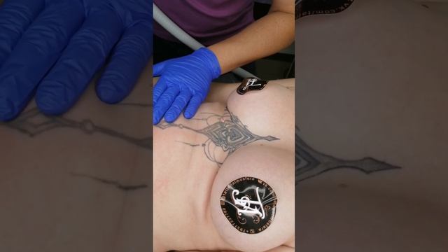 Удаление татуировок и татуажа в Волгограде. смотреть онлайн