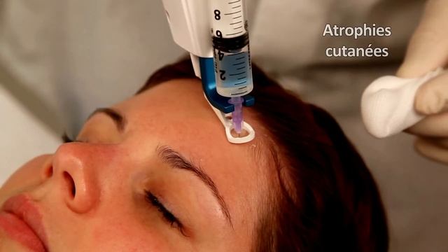 K-SURGERY και PISTOR ELIANCE από την MediconTec смотреть онлайн