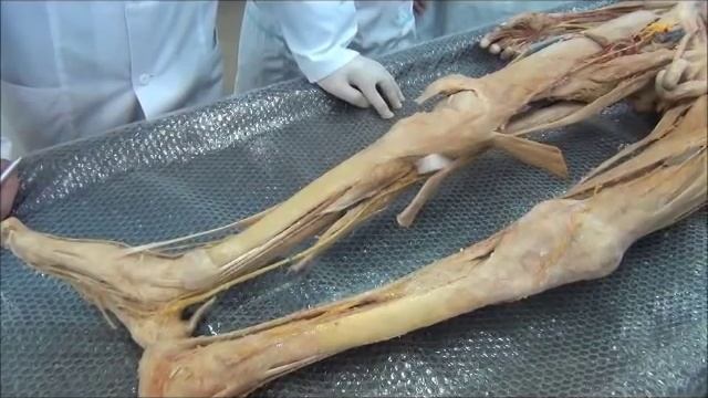 Анатомия. Мышцы и нервы нижней конечности. смотреть онлайн