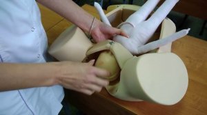 Биомеханизм родов при переднеголовном предлежании