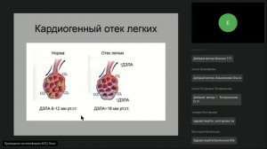 Клиника, диагностика и лечение острой сердечной недостаточности