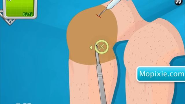 OPERATE NOW : KNEE SURGERY | PLAY SURGERY GAMES смотреть онлайн