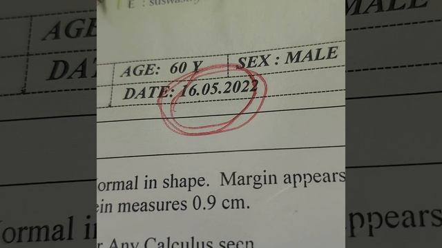 Thuja Occidentalis смотреть онлайн