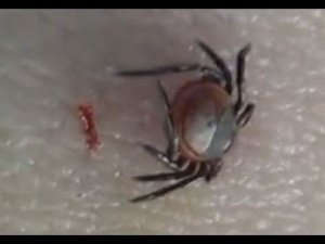 Энцефалитный клещ - МОЖЕТ ВПИВАТЬСЯ НЕСКОЛЬКО РАЗ - на Рыбалке Охоте в Походе в Тайге в Лесу