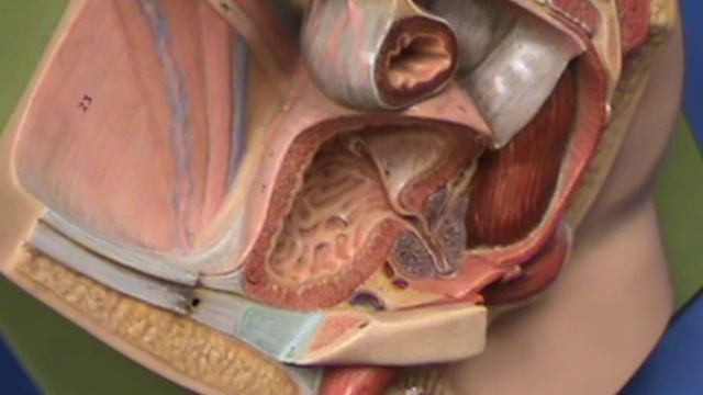 Male Reproductive Model - Plaque Model - Urinary Bladder.avi смотреть онлайн