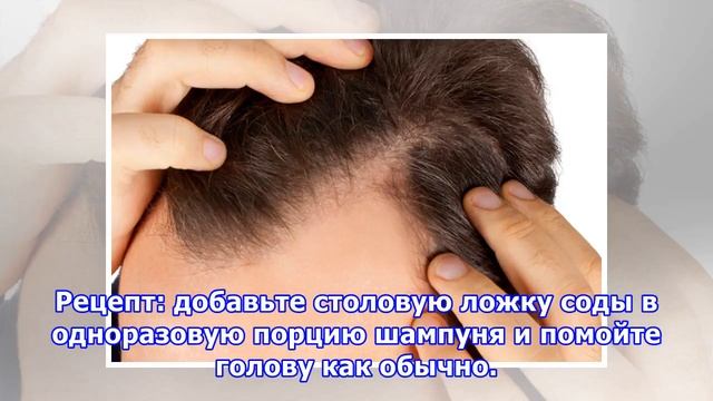Как избавиться от перхоти: 10 проверенных средств смотреть онлайн