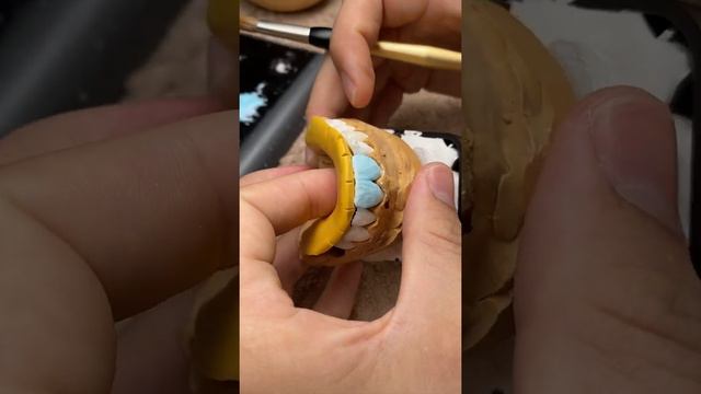 Veneers on refractory виниры зубной техник dental technician смотреть онлайн