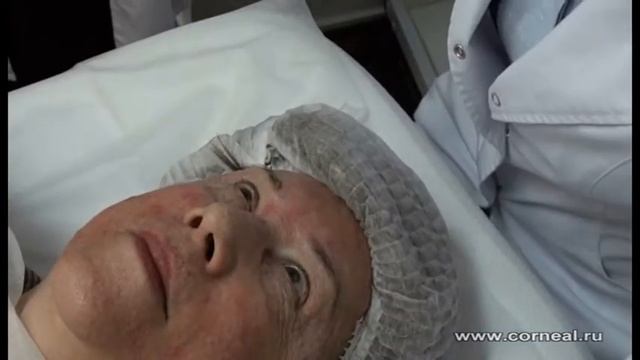 Действенная альтернатива биоревитализации смотреть онлайн