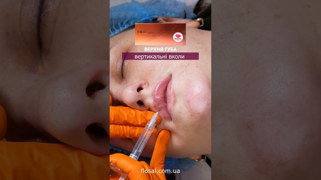 Техніки створення чуттєвих губ з 💉MiFill Volume смотреть онлайн