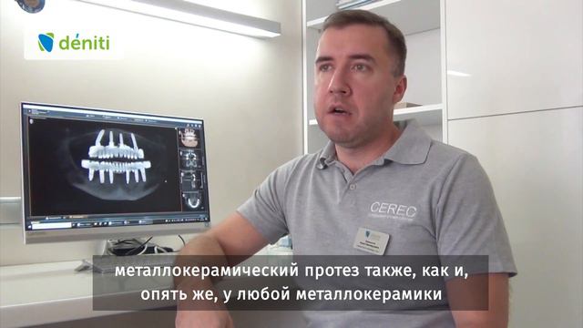 Есть ли осложнения при протезировании «всё-на-4»? смотреть онлайн