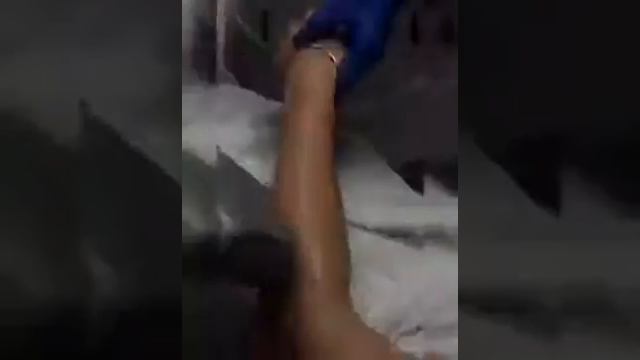 Может ли лазерная эпиляция избавить от волос навсегда? смотреть онлайн