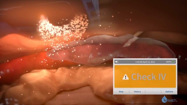 How it Works - ivWatch Model 400 Training Video смотреть онлайн