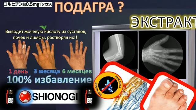 Средство от подагры. Лучшее , снимает приступ за один прием, применение раз в неделю смотреть онлайн