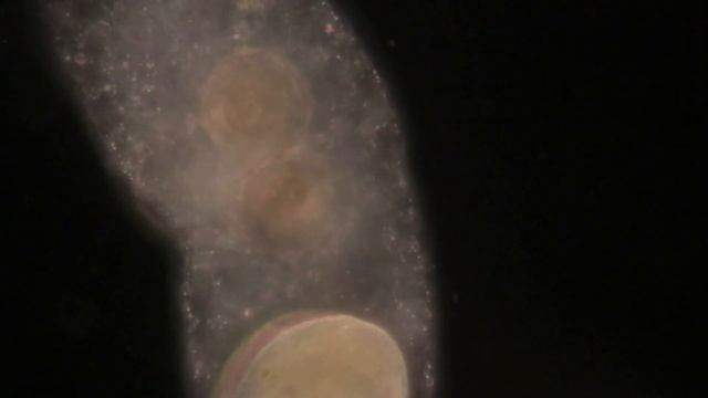 Большая подборка микроорганизмов под микроскопом в HD качестве смотреть онлайн