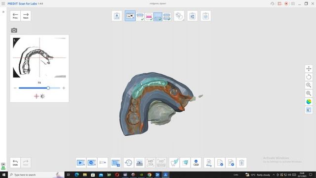 How to Invert Impression with Medit T310 and ExoCad. смотреть онлайн