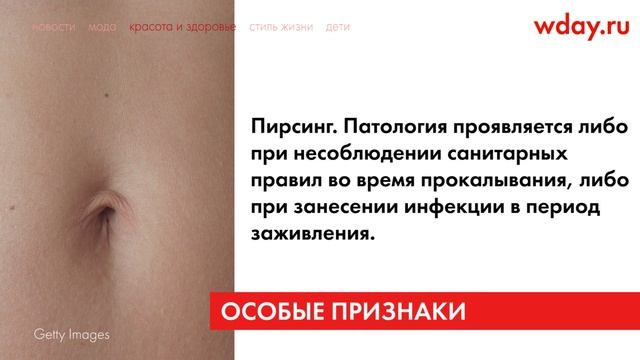 Выделения из пупка с запахом: с чего бы вдруг? смотреть онлайн