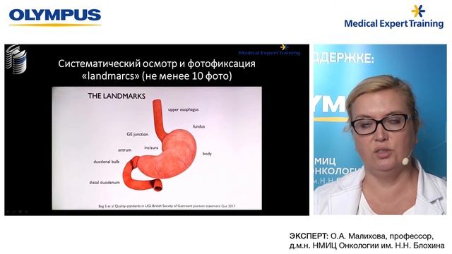 Диагностика предраковых изменений и состояний желудка. Стандарты и новые технологии. О. А. Малихова смотреть онлайн