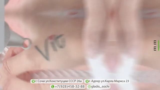 Лазерная эпиляция в Сочи Gladis смотреть онлайн