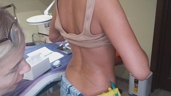 Липолитик LipoLax(Корея)