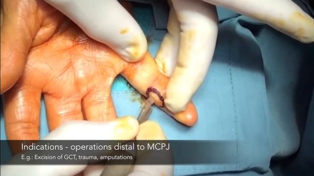 SIMPLE block смотреть онлайн