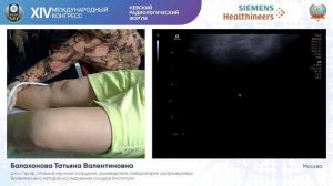 МАСТЕР-КЛАСС "УЗД визуализация атеросклероза: сонные и бедренные артерии, аорта"