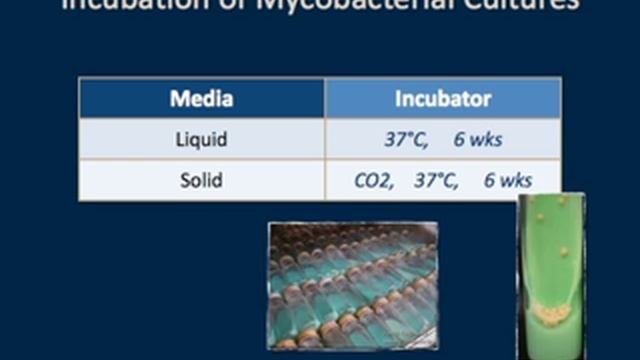 Diagnosis of Tuberculosis by N Banaei, Stanford University смотреть онлайн