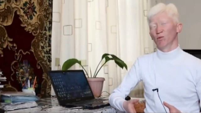 "Мне больно когда на меня смотрят" Казахстанец с добрым сердцем но ......... До слёз История смотреть онлайн