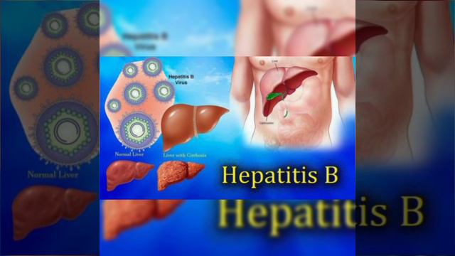 Hepatitis Care Pack смотреть онлайн
