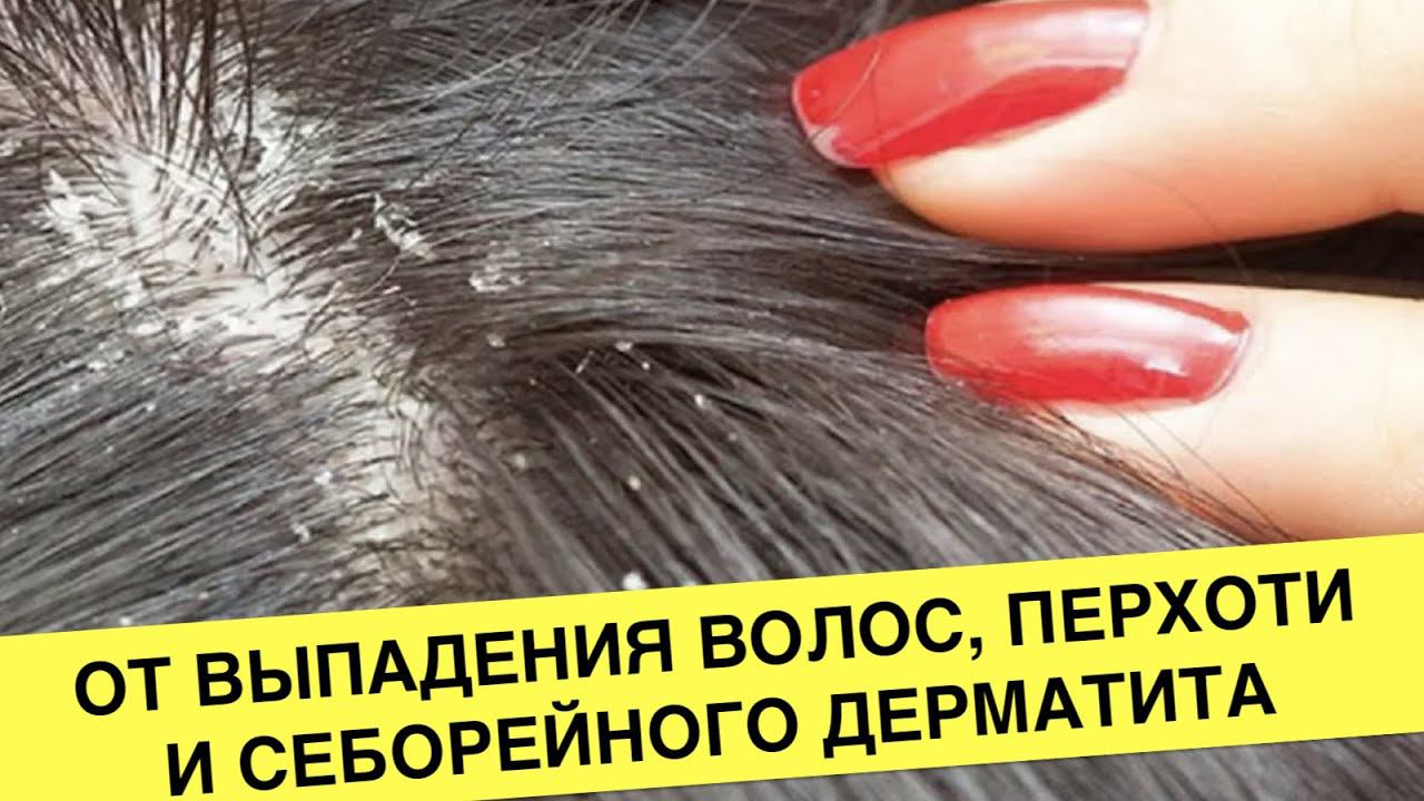 Средство от себореи, перхоти и выпадения волос в домашних условиях, для блеска волос Ева Лорман смотреть онлайн