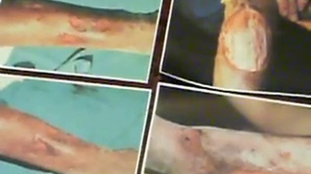 Pit Bull Attacked Greyhound смотреть онлайн