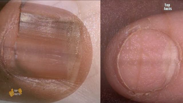 ПРО ЧТО ГОВОРЯТ НОГТИ? смотреть онлайн