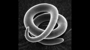 Трихинелла - Trichinella spiralis - Трихинеллез: Жизненный Цикл, Симптомы, Диагностика, Профилактик