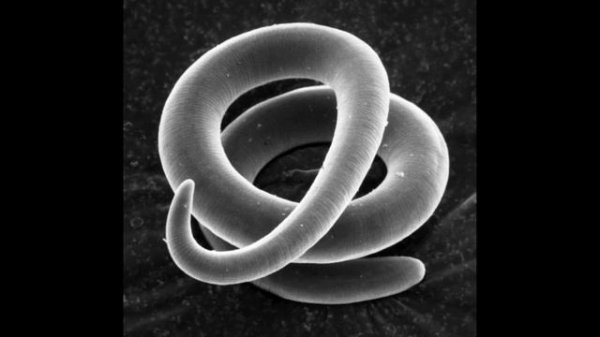 Трихинелла - Trichinella spiralis - Трихинеллез: Жизненный Цикл, Симптомы, Диагностика, Профилактик