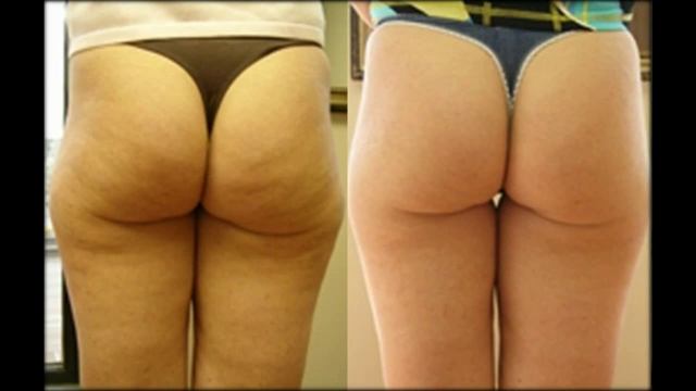 похудеть пить много воды смотреть онлайн