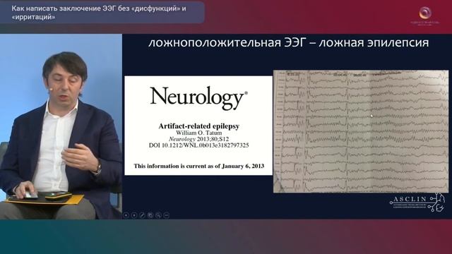 Как написать заключение ЭЭГ без дисфункций и ирритаций